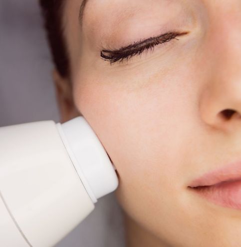 PULIZIA VISO CON MACCHINARIO